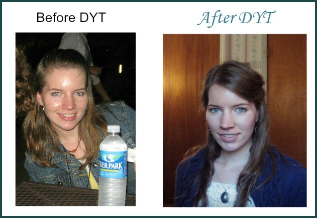 DYT before after 4